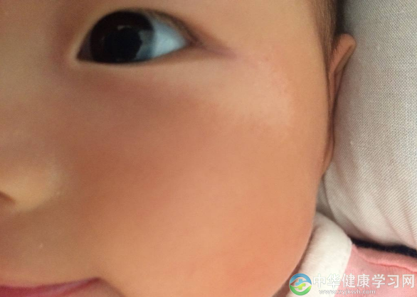 幼童厌食、挑食、食欲不振，多半是该吃打虫药了