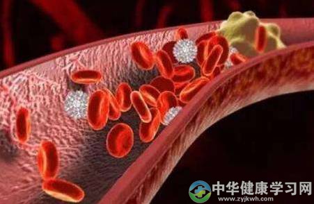 如果你近来经常出现这3个症状，注意了，可能是血栓前兆