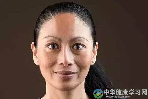 为什么你的面色一直这么黄？可能是这些方面出现了问题